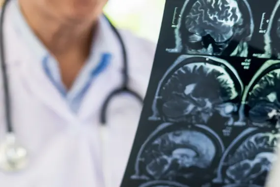 Neurology results being viewed 