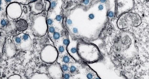 covid 10 grey image_1